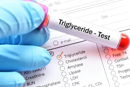 trigliserida adalah