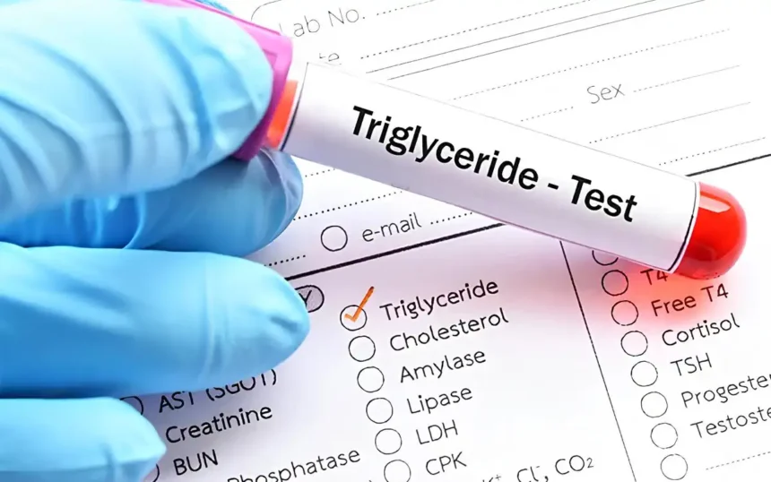 trigliserida adalah