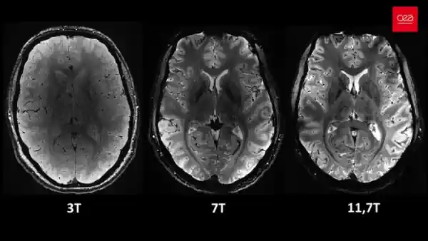 mri scan